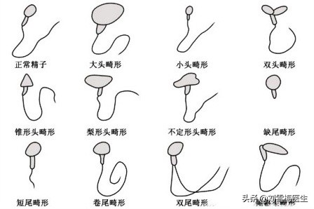 卵子也“看脸”长相不好受孕难你的这4个习惯让精子越长越丑