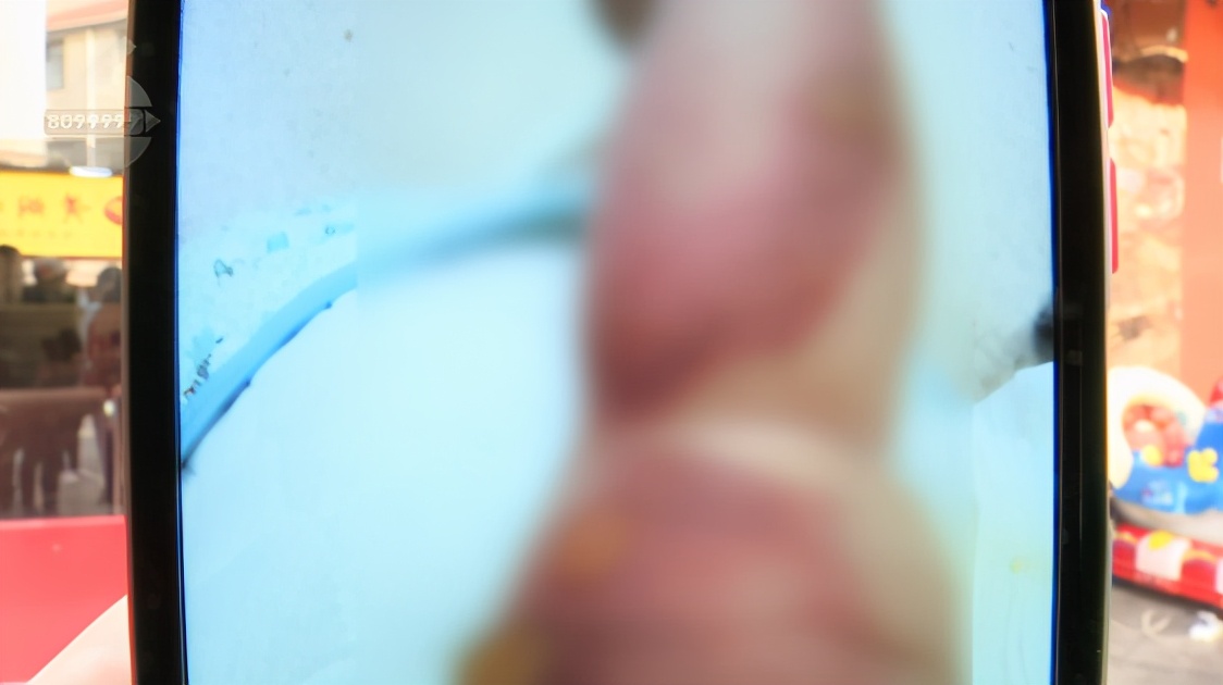 小孩在店里被烫伤要赔多少钱,母婴店洗澡被烫着的孩子