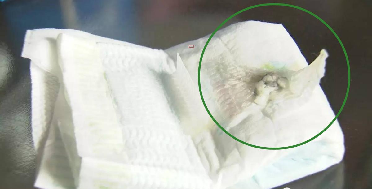 宝宝尿液出现2种颜色，或是身体发出的“健康信号”，父母要重视