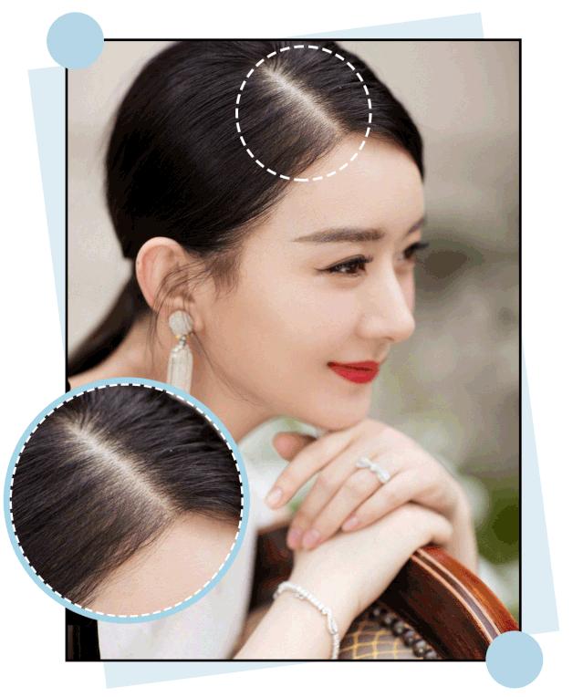 赵丽颖秃头照,赵丽颖秃顶原因