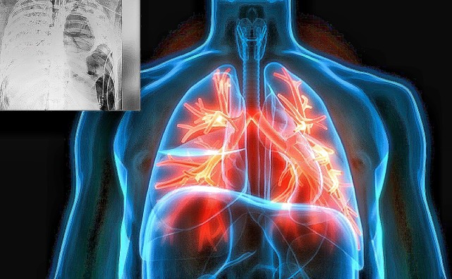 墨西哥男子街头中枪倒地,墨西哥男子淡定面对死亡