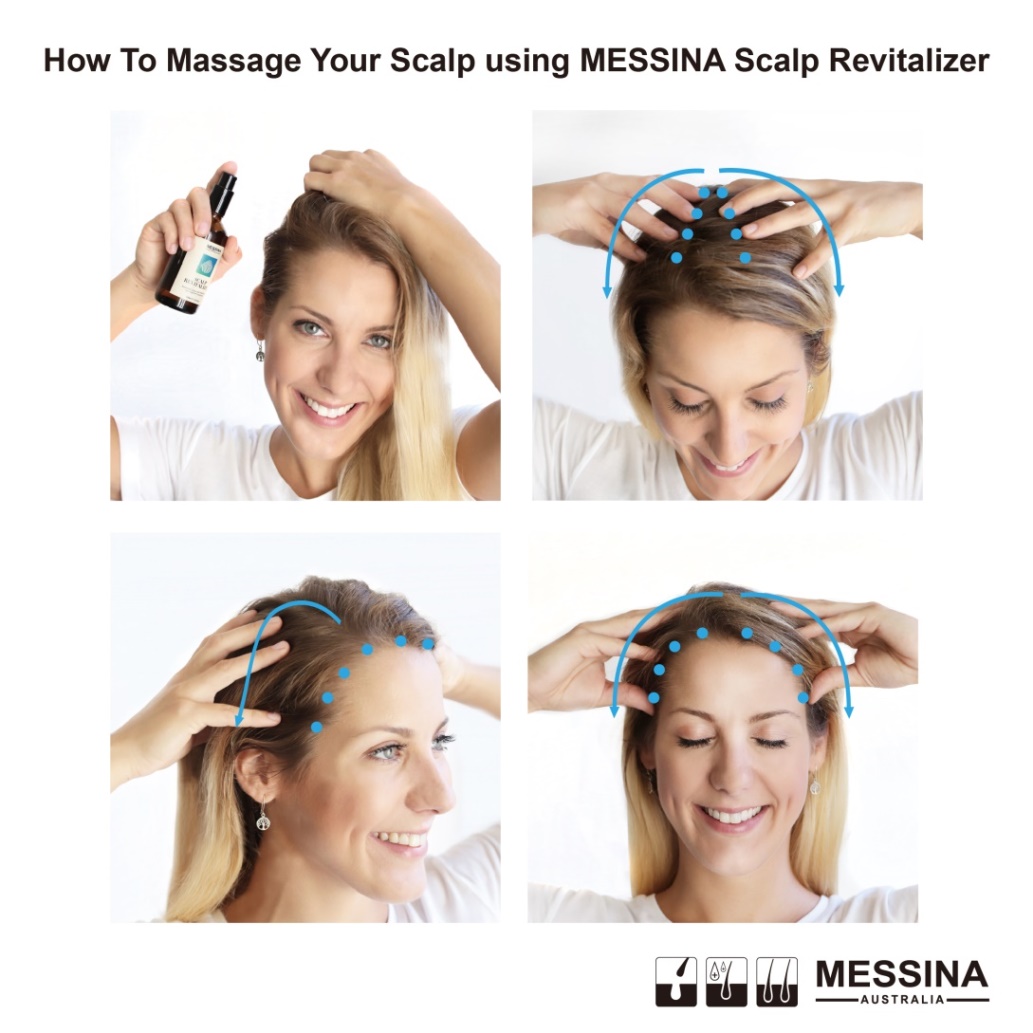 脱发脱成灭霸，我加入了妇愁者联盟！澳洲messina带你找回自信