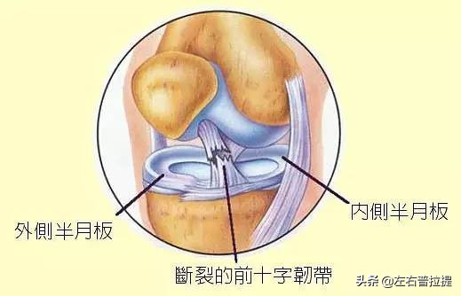 膝关节置换后的康复锻炼方法视频,膝盖痛锻炼膝盖的正确方法