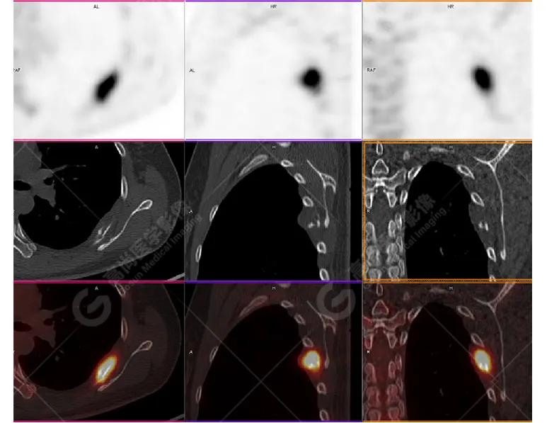 女性防癌检查科普,妇女宫颈癌及乳腺癌筛查情况年报