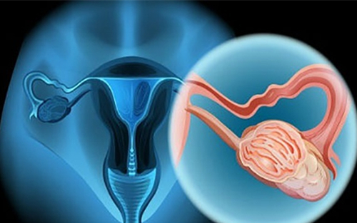 阴道出血什么症状排除是宫颈癌,阴道出血是宫颈癌的主要症状吗