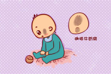 小孩常见的胎记都有哪些,宝宝的胎记有什么寓意