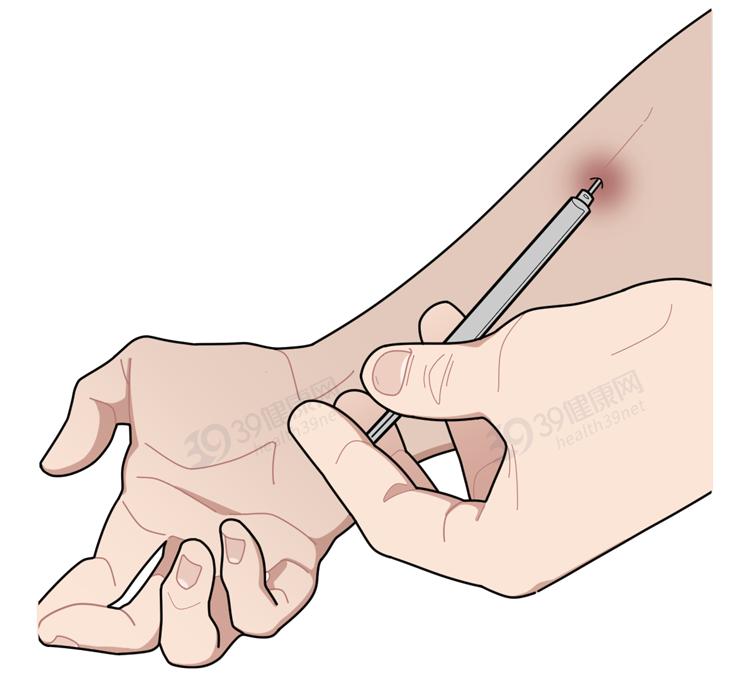 怎样辨别人吸毒,怎么分辨一个人是否吸毒