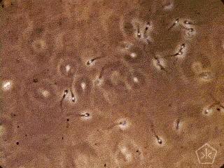 看呆医生：一次成功！医院人工授精太贵，英女子购买针筒自行操作