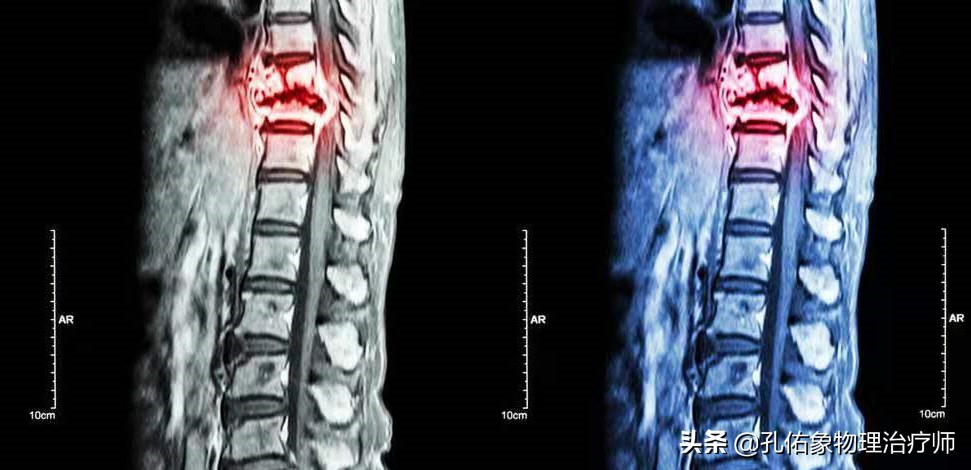 胸和肩胛骨疼痛是什么原因,右胸和后背肩胛骨疼痛是什么原因