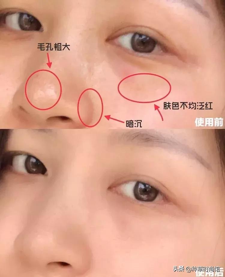 脸色暗黄干皮怎么变白最快方法,暗黄皮用什么护肤品变白