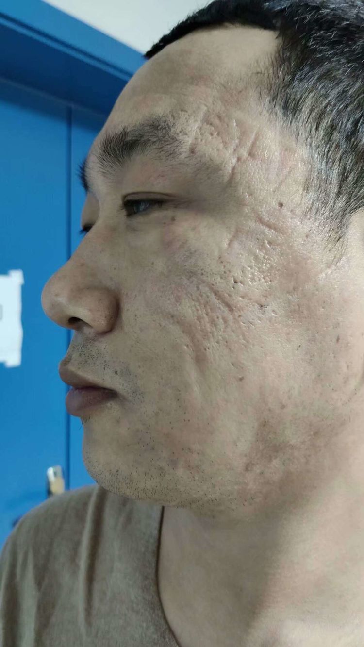 援鄂抗疫,援鄂抗击疫情英雄归来