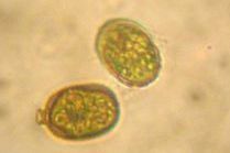 对虾池塘黑褐色泡沫聚集原因,池塘水全部呈黑褐色什么原因