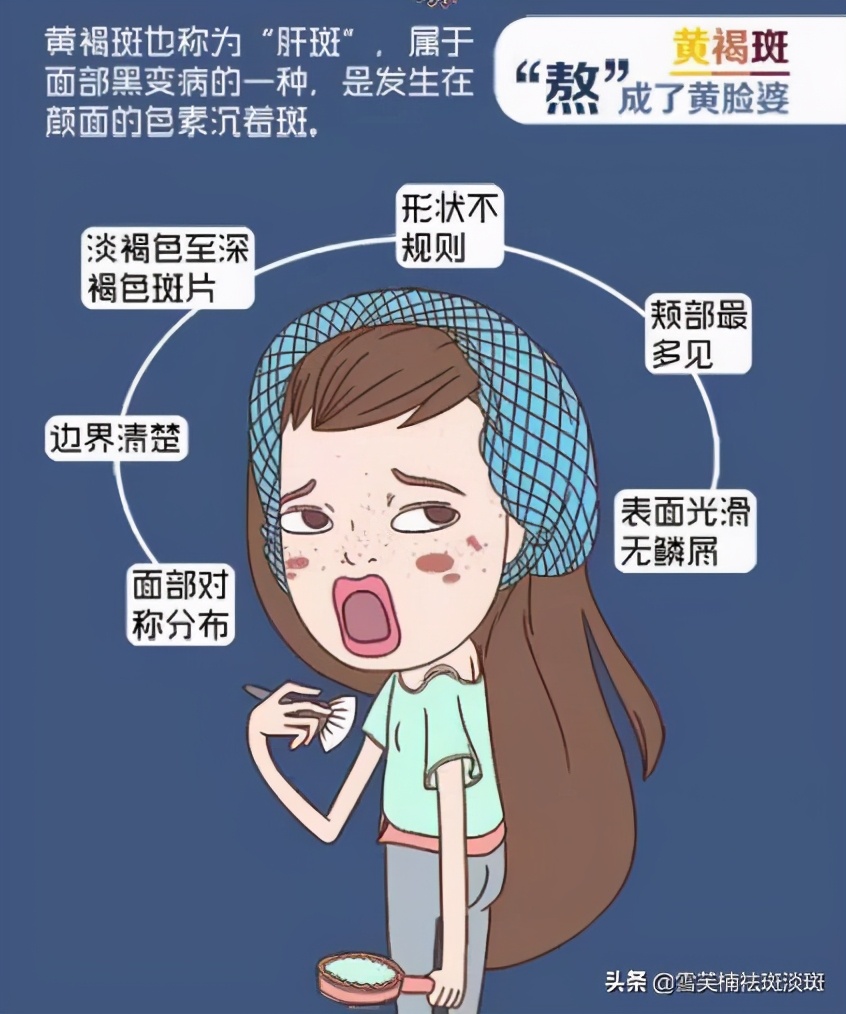 怎么祛斑方法最快最有效不反弹,怎样祛斑美白最快最有效