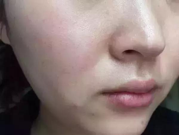 姘ㄥ熀閰稿噣閫忕編鐧芥磥闈钩鐩存挱,姘ㄥ熀閰告场娌礂闈㈠ザ缇庣櫧鐩存挱