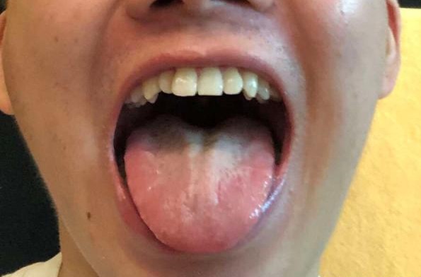 高音技巧咽音,咽音突破高音教程