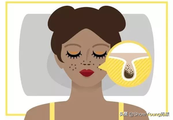 自制拯救垮脸最有效秘方,烂脸最有效的方法