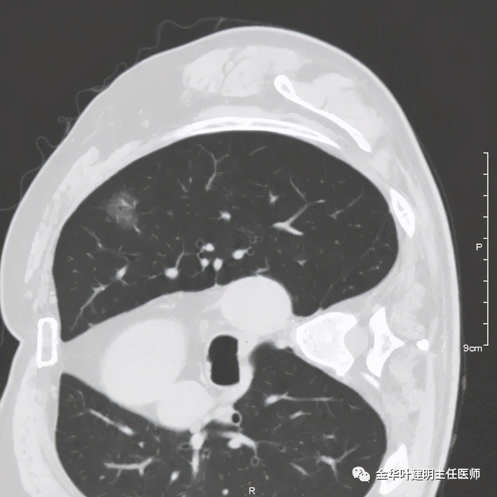 放个大招完整版教学,放个大招完整版前奏