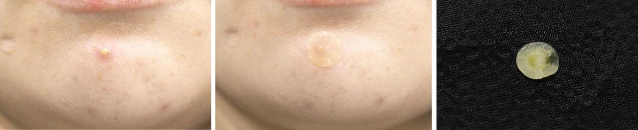 双11捡漏,最后捡漏144万元