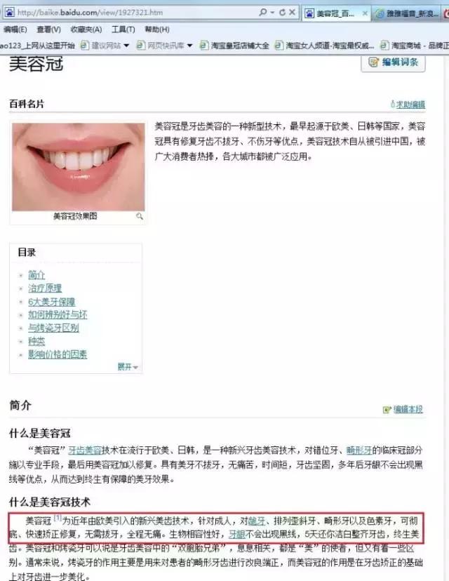 美容冠是指的什么,美容冠到底是什么