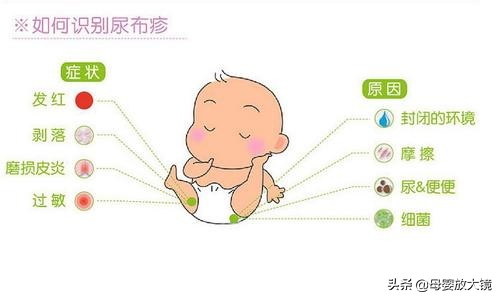 新生儿宝宝如何护理常识,宝宝常见疾病预防及日常护理