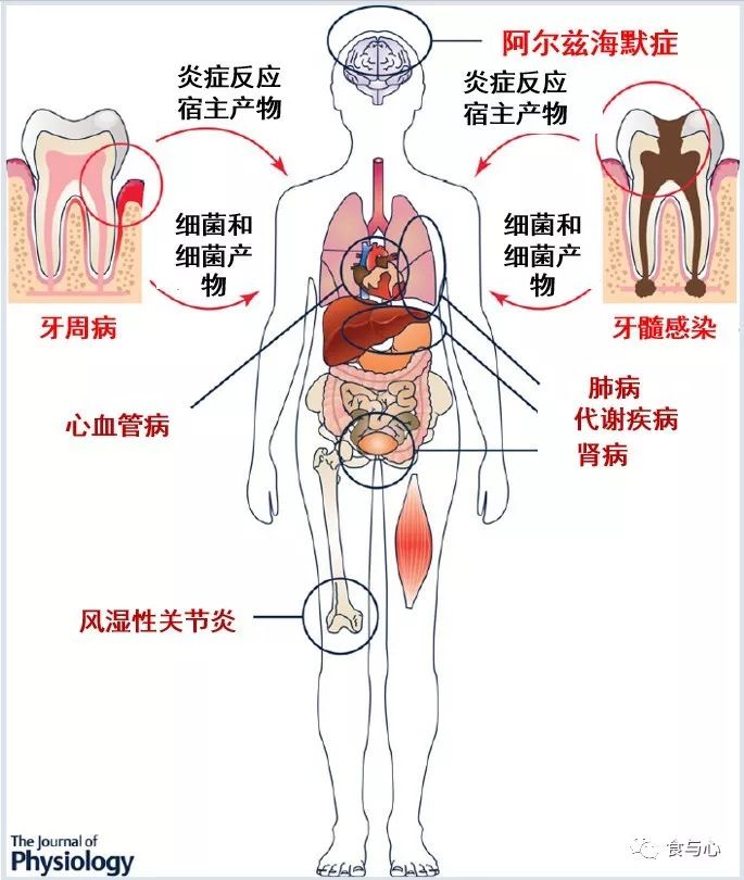 肠漏症的三大指标,肠漏症和脑漏症