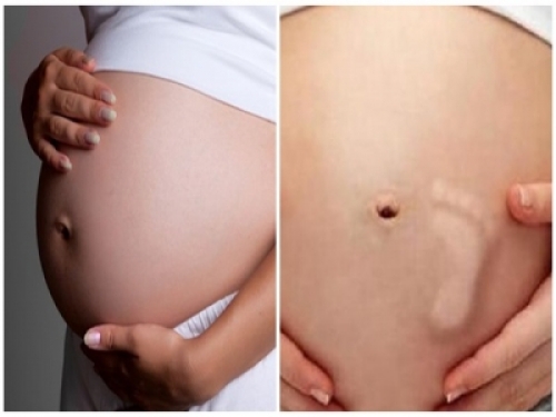 孕妇肚子疼跟宫缩一样怎么回事,孕晚期怎么分辨胎动疼还是宫缩疼