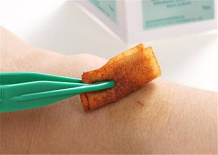 碘伏为什么可以杀菌消毒,碘伏消毒液有毒吗