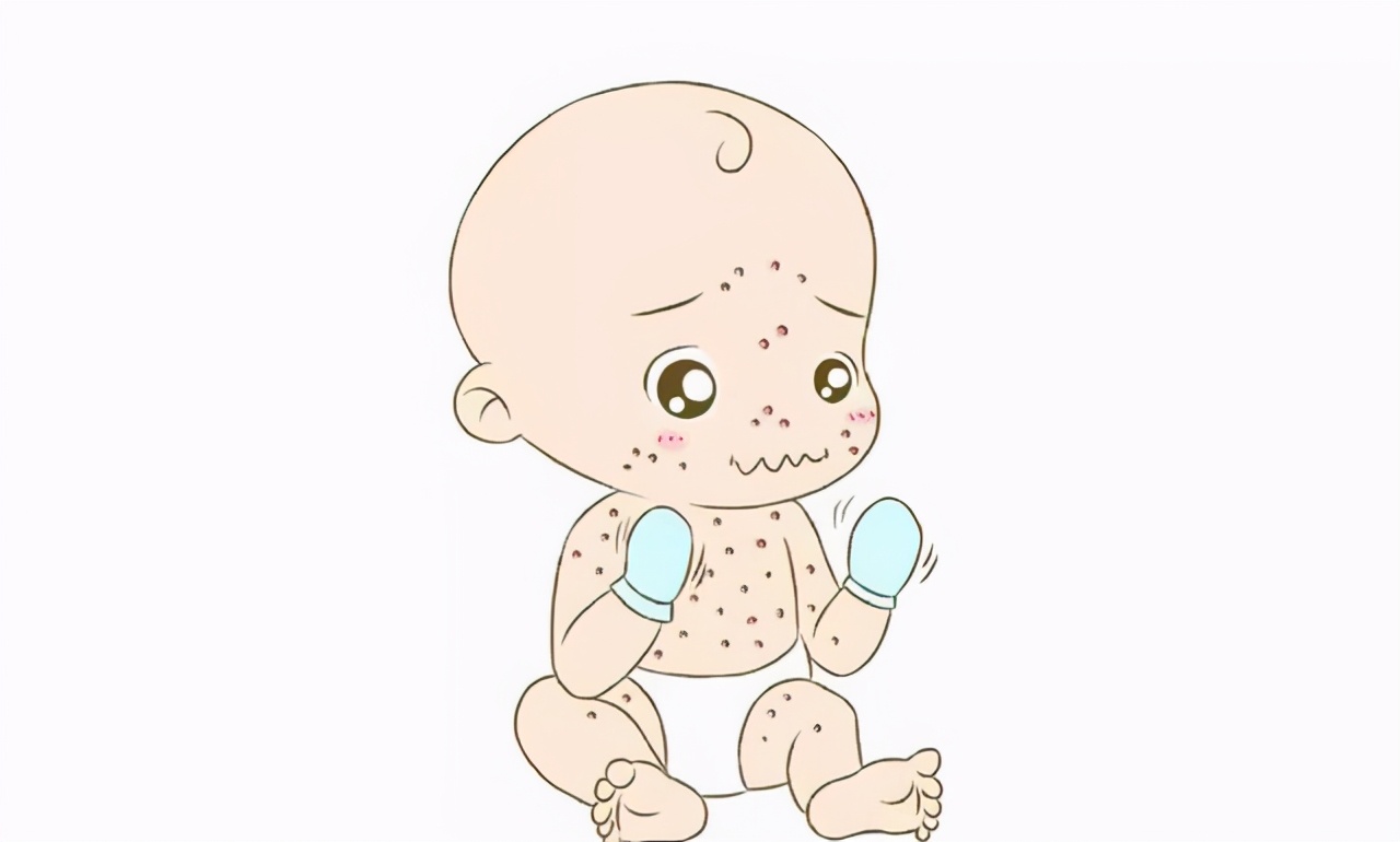 不想宝宝皮肤干燥过敏，这些方法帮你搞定