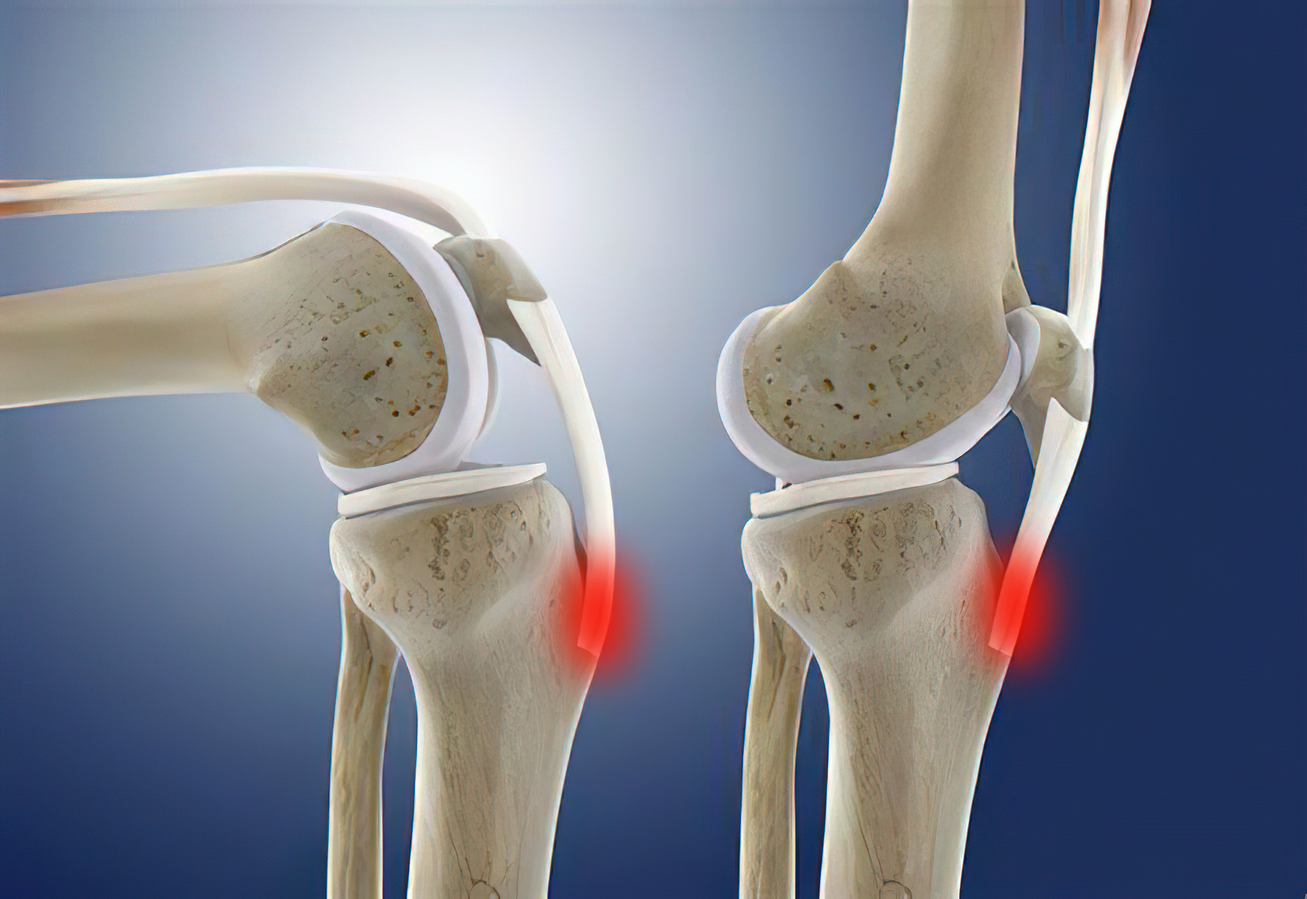 老人总是膝盖疼两大治疗方法,老年人上下楼梯膝盖疼