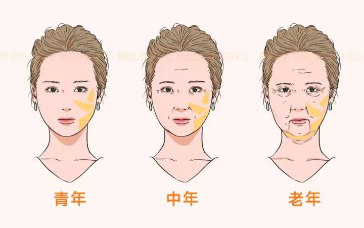 面部吸脂可以瘦脸,面部吸脂全脸什么部位不能吸