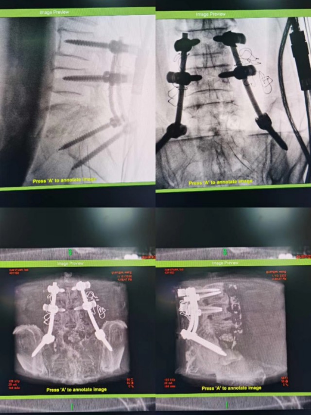 牙齿不好引发的疾病视频,牙齿有问题不做根管治疗会怎么样