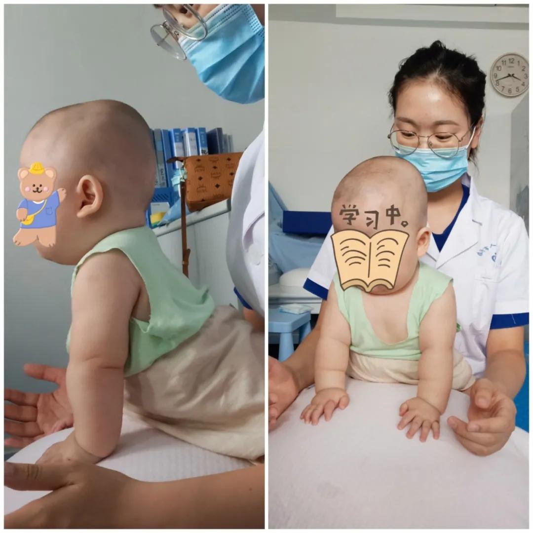 大运动发育迟缓但精细运动正常,如何判断宝宝是否运动发育迟缓