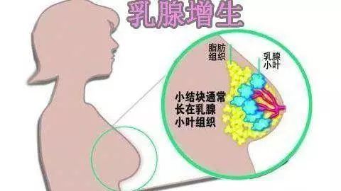 乳腺疾病与乳腺癌的区别,良性就不是癌了吧
