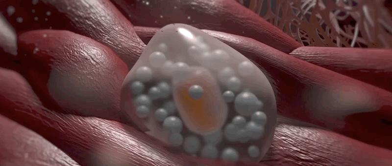 哮喘的发病原理,哮喘科普文章作品简介