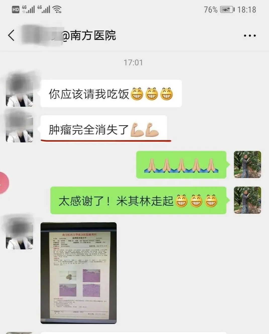 胃癌已转移到腹膜了严重吗,胃癌晚期转移到肝导致肝昏迷