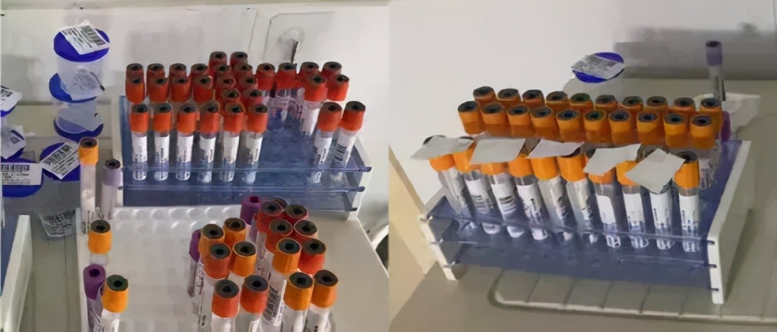 河南省人民医院代谢科,河南省人民医院豫东南分院