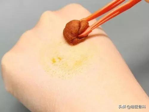 正确的伤口消毒方法,伤口怎么消毒最好的方法