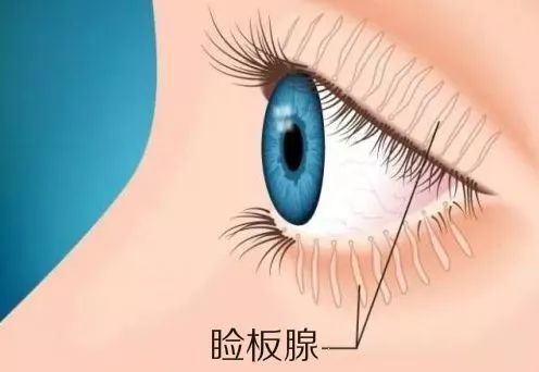 干眼症可以彻底治愈吗,干眼症能彻底治好吗