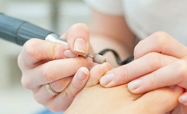 指甲长在了肉里修脚店可以处理吗,指甲嵌入肉了自己剪掉没关系不