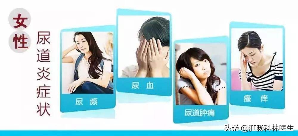 疫情下如何有效防治女性尿道炎？