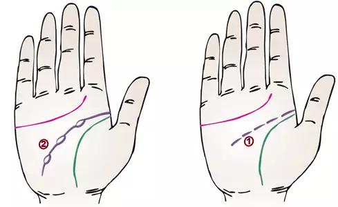 掌纹诊病图片,掌纹能查出糖尿病吗