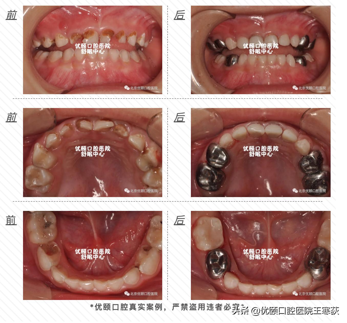 这个暑期优颐“舒眠中心”有点忙