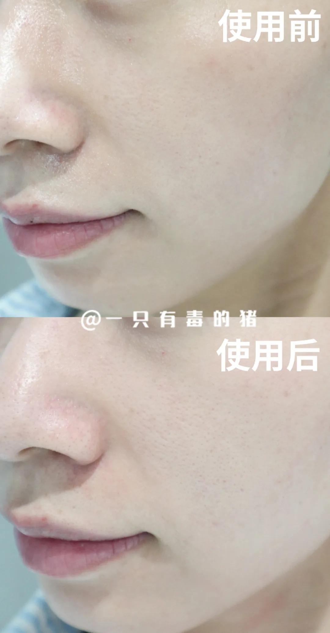 有哪些冷门好用的面膜,fresh和科颜氏白泥面膜哪个好用