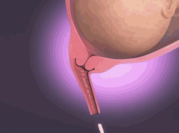 生了二胎怎么才能教好大宝,二胎生孩子如何正确用力