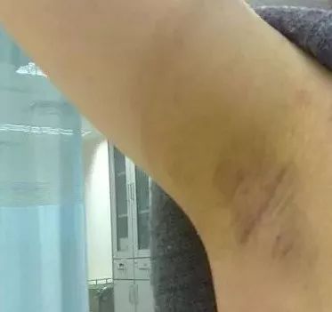 有“味”道1·夏日来袭如何不做“有味”一族