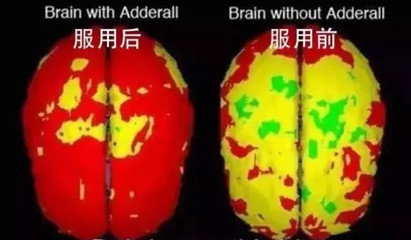 “大脑伟哥”年销80亿片！无数美国高材生中招，魔爪正在伸向中国