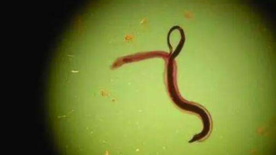 外阴瘙痒去挠会变黑,细菌滋生后惊喜不断,爱美女性还放心吗