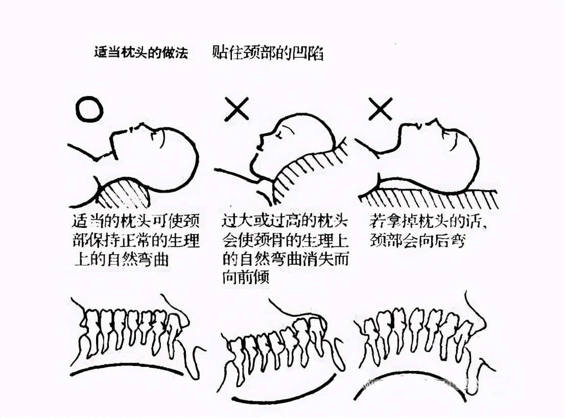 夺命包和富贵包的区别,富贵包夺命包什么意思