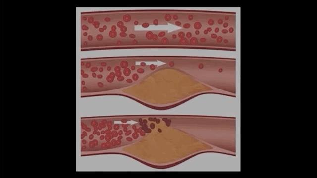七种方法让你戒掉糖瘾,糖无处不在如何戒糖