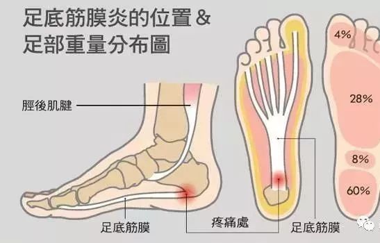 肌筋膜炎做什么检查能查出来,肌筋膜炎最佳治疗方法